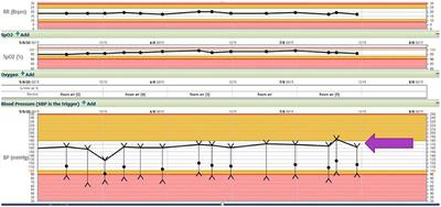 Case Report: Posterior Reversible Leukoencephalopathy Syndrome (PRES) as a Biologically Predictable Neurological Association in Severe COVID-19. First Reported Case From Australia and Review of Internationally Published Cases